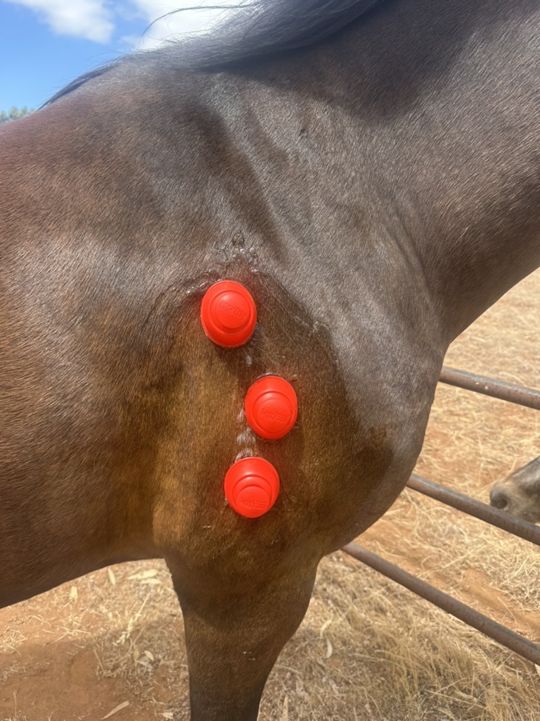 Tricep Cupping